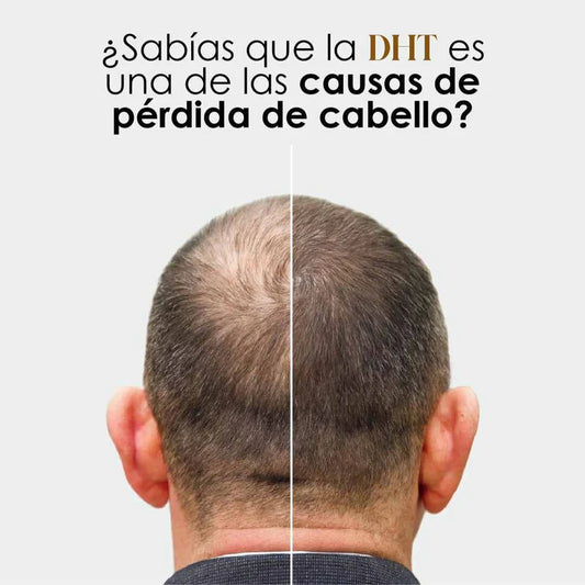 DHT Blocker Anticaída Premium™ – Cabello Fuerte y Abundante