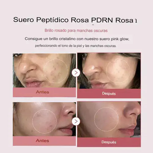 Medicube PDRN®  (ADN de salmón) Suero de péptido rosa - 30 ml