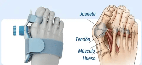 JuanetFlex® OrthoCare