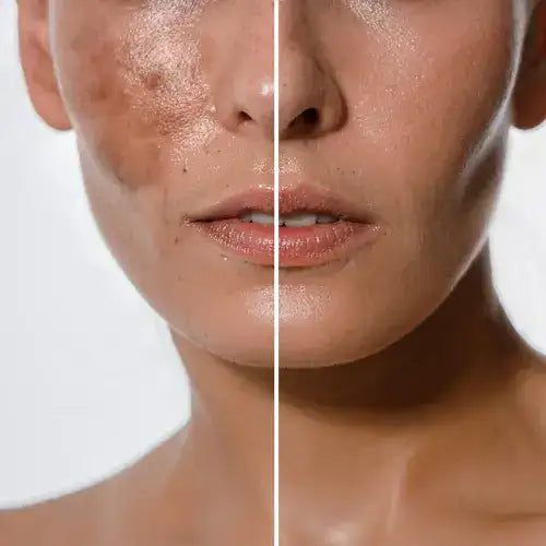 Kit Serum Kojic 35ml + Jabon limpiador Kojic ¡Despídete de las Manchas!