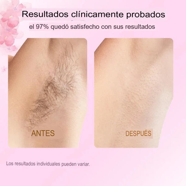 Cyperus Rotundus Oil™ Elimina  vellos no desados, puntos encarnados , reduce  la irritación y mejorar la textura de la piel.