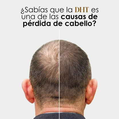 DHT Blocker Anticaída Premium™ – Cabello Fuerte y Abundante