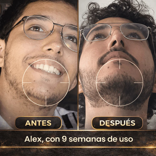 Dermo-Bálsamo Crecimiento Barba y Bigote (Minoxidil 20%) 100ml