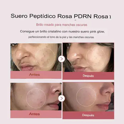 Medicube PDRN®  (ADN de salmón) Suero de péptido rosa - 30 ml