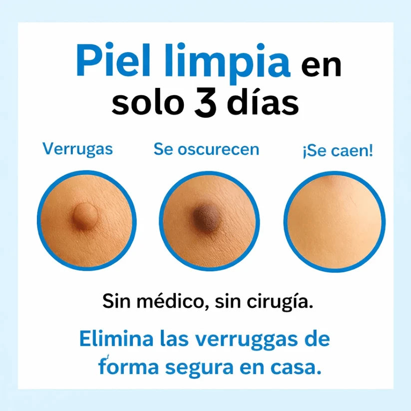 VerruOff™ – Eliminador de Verrugas e Imperfecciones de la Piel