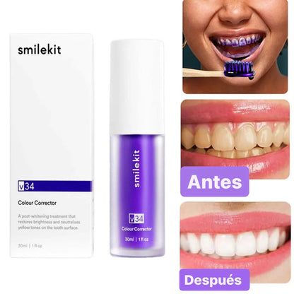 CREMA SMAIL BLANQUEADORA ¡NO MÁS DIENTES AMARILLOS!