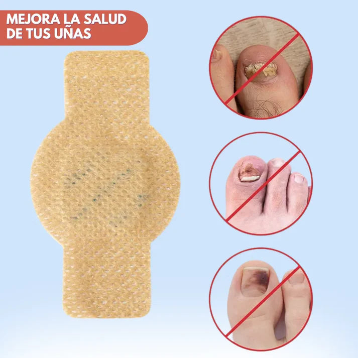 PureSkin 360™ Parches Antihongos - Eliminan Hongos y Regenera tus uñas