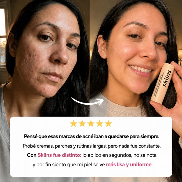 Barra de silicona de grado médico para cicatrices™🎁¡HOY EN OFERTA RECIBE 2 BARRAS!