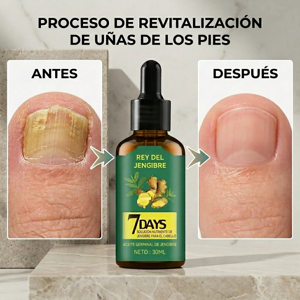 🎁 X2 frascos 7 Days Fungus Free Nails® Protege y elimina el hongo de tus Uñas