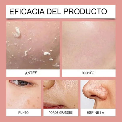 Aclarante Glow™ ¡Aclara zonas difíciles, tu secreto para una piel más clara, suave y segura en TODO tu cuerpo.!