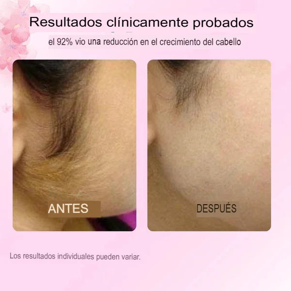 Cyperus Rotundus Oil™ Elimina  vellos no desados, puntos encarnados , reduce  la irritación y mejorar la textura de la piel.