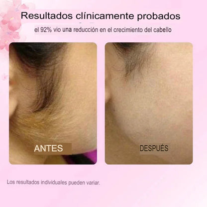 Cyperus Rotundus Oil™ Elimina  vellos no desados, puntos encarnados , reduce  la irritación y mejorar la textura de la piel.