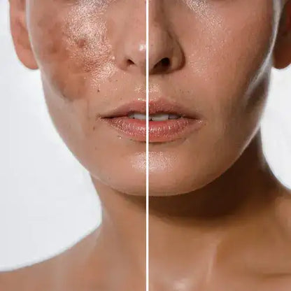 Kit Serum Kojic 35ml + Jabon limpiador Kojic ¡Despídete de las Manchas!